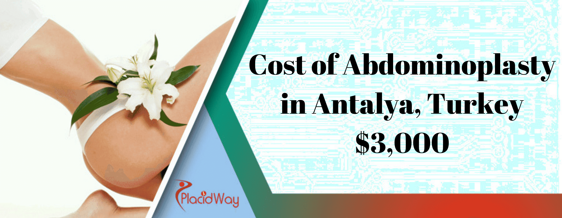 Cost of Abdominoplasty in Antalya, Turkey